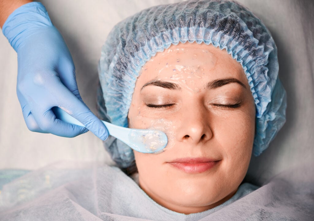 Cosmelan Peel Benefits