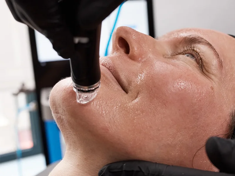 HydraFacial vs Other Facials